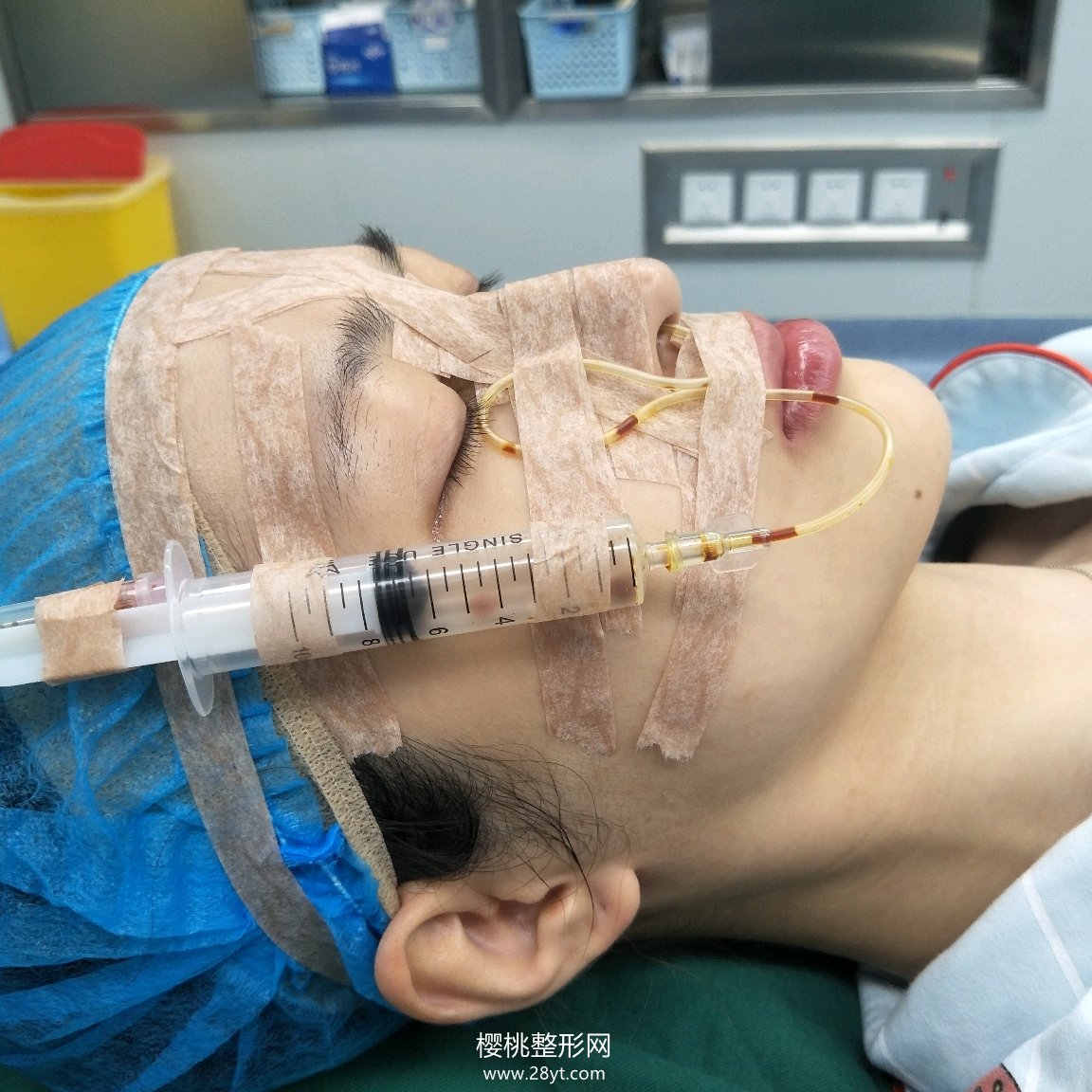 武汉匠歆天巧邓裴隆鼻技术如何？真人案例+最新价格表一览