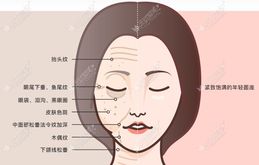 国内做拉皮手术口碑好的医生有哪些