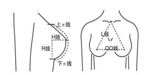 假体隆胸10个人有9个做完后悔？后遗症这么恐怖吗？