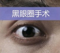 激光去黑眼圈会反弹吗