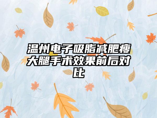 温州电子吸脂减肥瘦大腿手术效果前后对比