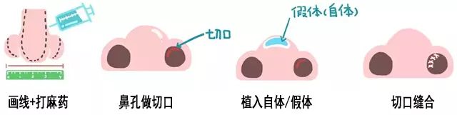 正颜可以不精致，但侧颜一定要迷人