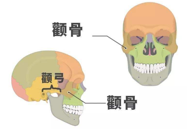 邱立东：颧骨内推后变丑是怎么回事?