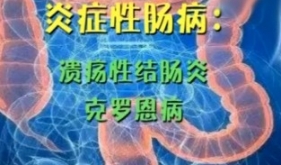 为爱发声——我是IBD，我分享IBD