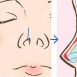 膨体加耳软骨隆鼻即不会下滑，塑形效果也接近自然